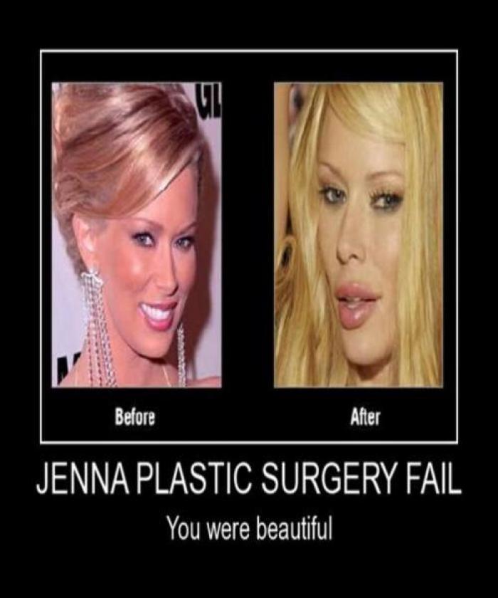 Jenna Plastic Surgery
